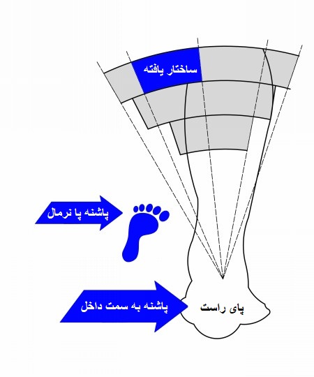 قوس پای استاندارد